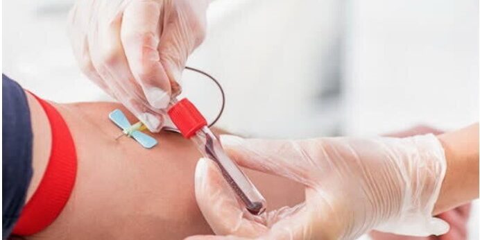 متخصص+خون+از+چه+آزمایش+هایی+برای+تشخیص+استفاده+می+کند؟