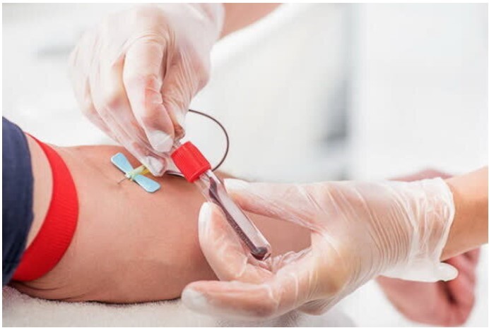 متخصص+خون+از+چه+آزمایش+هایی+برای+تشخیص+استفاده+می+کند؟